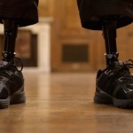 Amputated Feet