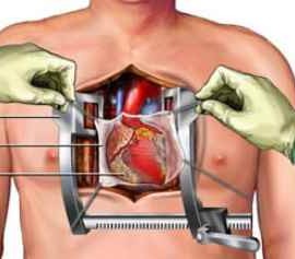 Joshua Tinworth | Hypoplastic Left Heart Syndrome | Victor Tsang