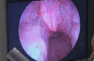 Camera's View of Kody's Throat