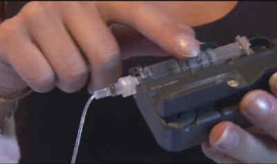Leanne's subcutaneous Pump