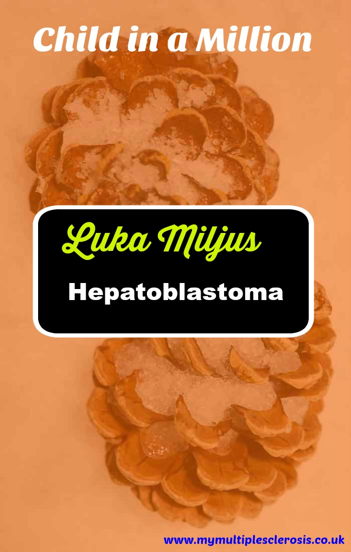 Luka Miljus Hepatoblastoma, a malignant cancer of the kidney