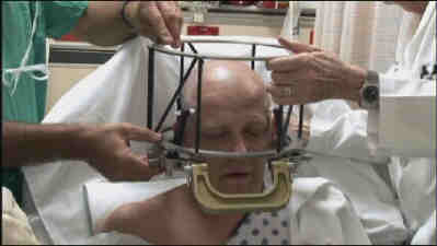 Cranial Scaffold