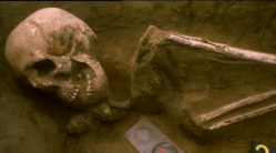 Skeletal Remains