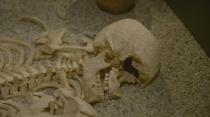 Skeletal Remains