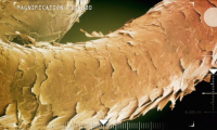 Magnified Human Hair Small Universe