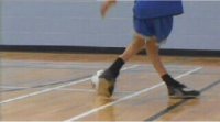Bent and Deformed Legs