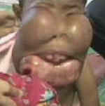 Before Surgery