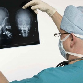 Multiple Sclerosis Symptoms what to expect