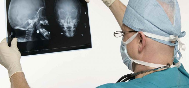 General MS Symptoms