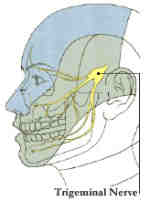 trigeminal neuralgia