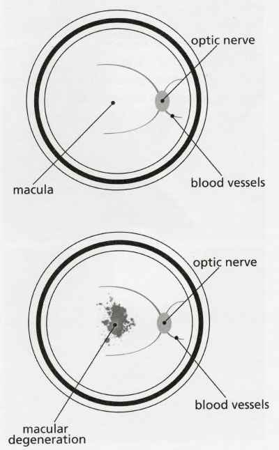 Macula Eye Image