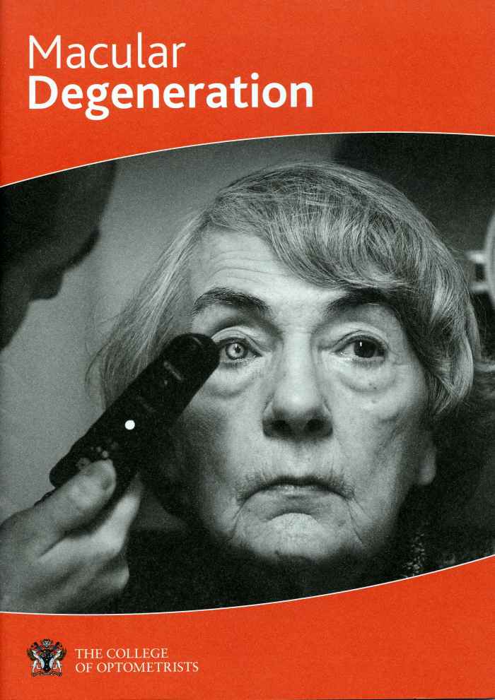 macular degeneration md-amd-vision