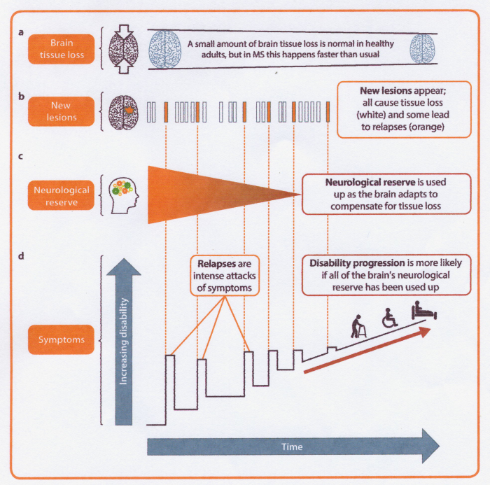 Disease Progression Neurological Reserve Brain Lesions Symptoms Multiple Sclerosis