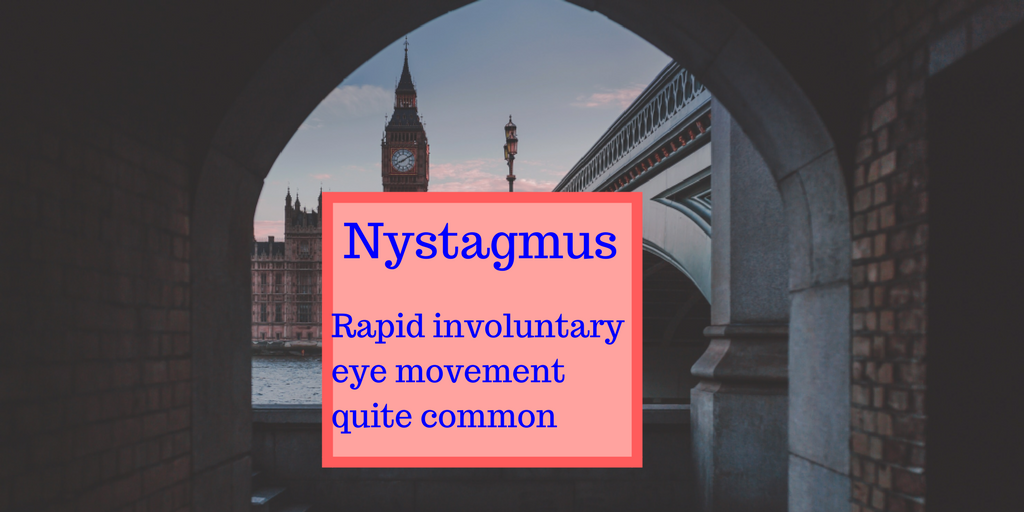 Nystagmus Involuntary eye movement affects vision