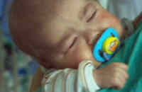 Toby the Baby with Ipex Syndrome