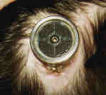 Bionic Vision Connector