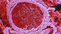 Alveoli